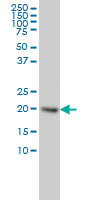 UBE2H monoclonal antibody (M01), clone 3C4-1A2 Western Blot analysis of UBE2H expression in HeLa.