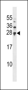 UBE2H Antibody western blot of A2058 cell line lysates (35 ug/lane). The UBE2H antibody detected the UBE2H protein (arrow).