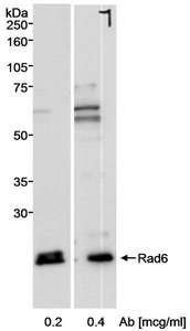 Detection of Human Rad6 by Western Blot. Samples: Whole cell lysate (50 ug) from 293T cells. Antibody: Affinity purified rabbit anti-Rad6 antibody used at the indicated concentrations. Detection: Chemiluminescence.