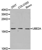 Western blot analysis of extracts of various cell lines, using UBE2A antibody.