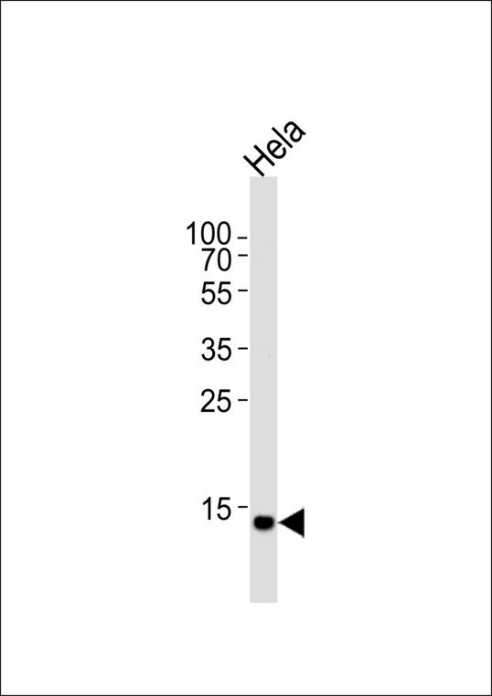 Western blot of lysate from HeLa cell line, using UBE2D2 Antibody. Antibody was diluted at 1:1000 at each lane. A goat anti-rabbit IgG H&L (HRP) at 1:5000 dilution was used as the secondary antibody. Lysate at 35ug per lane.