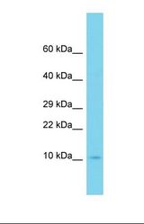 Western blot of Human MCF7. UBE2D4 antibody dilution 1.0 ug/ml.