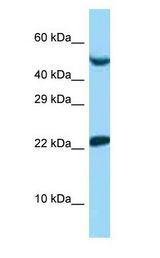 UBE2E1 / UBCH6 antibody Western Blot of 721_B.