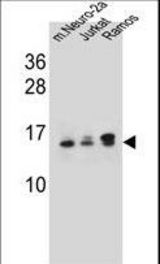 UBE2E2 Antibody western blot of mouse Neuro-2a,Jurkat,Ramos cell line lysates (35 ug/lane). The UBE2E2 antibody detected the UBE2E2 protein (arrow).