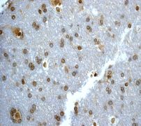 IHC of paraffin-embedded human brain tissue using anti-UBC9 antibody (LS-C105386).