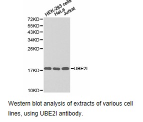 Western blot.