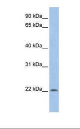 721_B cell lysate. Antibody concentration: 1.0 ug/ml. Gel concentration: 12%.