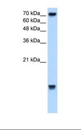 Jurkat cell lysate. Antibody concentration: 2.5 ug/ml. Gel concentration: 15%.
