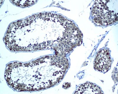 IHC of paraffin-embedded human testis tissue using anti-UBC13 antibody.