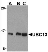 Western blot of UBC13 in human small intestine cell lysates with UBC13 antibody at (A) 0.5, (B) 1, and (C) 2 g/ml.