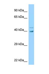 UBE2Q1 antibody LS-C146124 Western blot of HCT15 Cell lysate. Antibody concentration 1 ug/ml.