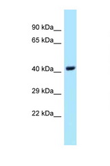 UBE2Q1 antibody LS-C146021 Western blot of Fetal Lung lysate. Antibody concentration 1 ug/ml.