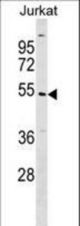 UBE2Q1 Antibody western blot of Jurkat cell line lysates (35 ug/lane). The UBE2Q1 antibody detected the UBE2Q1 protein (arrow).