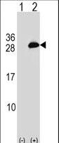 Western blot of UBE2T (arrow) using rabbit polyclonal UBE2T Antibody. 293 cell lysates (2 ug/lane) either nontransfected (Lane 1) or transiently transfected (Lane 2) with the UBE2T gene.