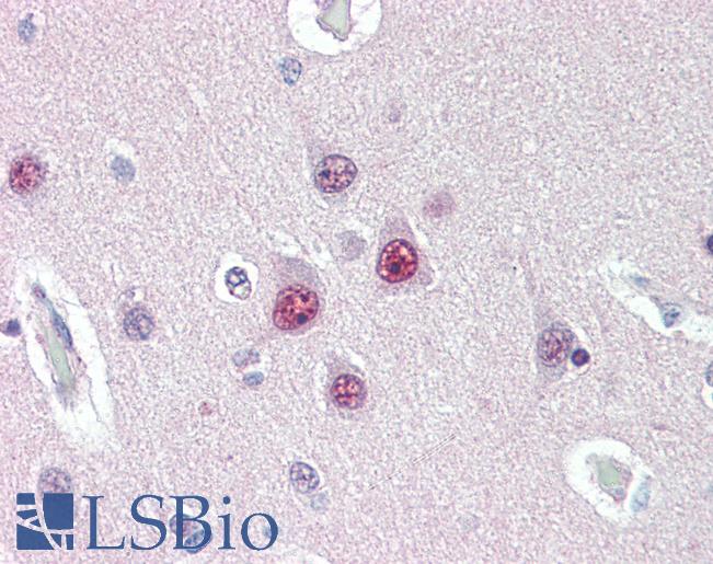 Anti-UBQLN1 antibody IHC of human brain, cortex. Immunohistochemistry of formalin-fixed, paraffin-embedded tissue after heat-induced antigen retrieval. Antibody LS-B3142 concentration 10 ug/ml.