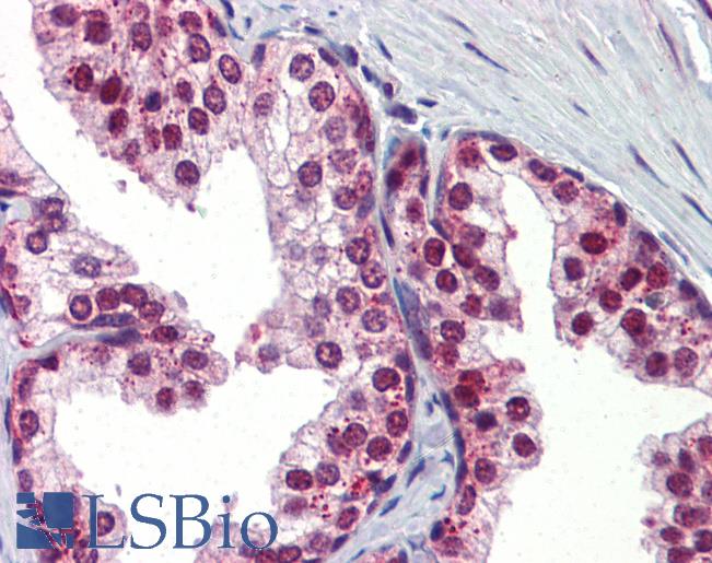 Anti-UBQLN1 antibody IHC of human prostate. Immunohistochemistry of formalin-fixed, paraffin-embedded tissue after heat-induced antigen retrieval. Antibody LS-B3574 concentration 5 ug/ml.
