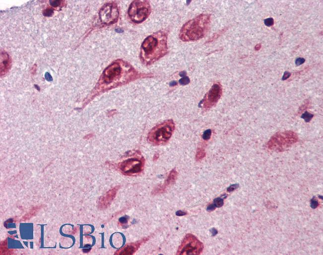Anti-UBQLN1 antibody IHC of human brain, cortex. Immunohistochemistry of formalin-fixed, paraffin-embedded tissue after heat-induced antigen retrieval. Antibody LS-B3574 concentration 5 ug/ml.