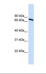 293T cell lysate. Antibody concentration: 1.0 ug/ml. Gel concentration: 12%.