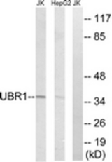 Western blot of extracts from HepG2/Jurkat cells, using UBR1 Antibody. The lane on the right is treated with the synthesized peptide.