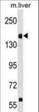 UBR1 Antibody western blot of mouse liver tissue lysates (35 ug/lane). The UBR1 antibody detected the UBR1 protein (arrow).