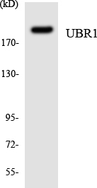 Western blot of the lysates from HUVEC cells using UBR1 antibody.