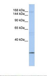 MCF7 cell lysate. Antibody concentration: 1.0 ug/ml. Gel concentration: 6-18%.