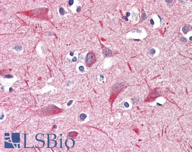 Anti-UBR2 antibody IHC staining of human brain, cortex. Immunohistochemistry of formalin-fixed, paraffin-embedded tissue after heat-induced antigen retrieval. Antibody LS-B9517 concentration 5 ug/ml.