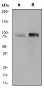 Western blot analysis on (A) HeLa and (B) A431 cell lysates using anti-UBF antibody (cat.#2406-1).
