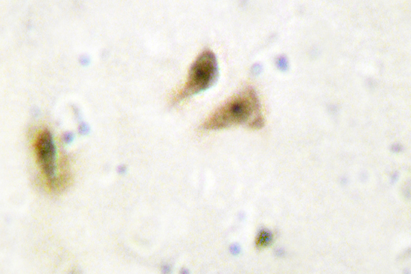 IHC of UBF-1 (E536) pAb in paraffin-embedded human brain tissue.