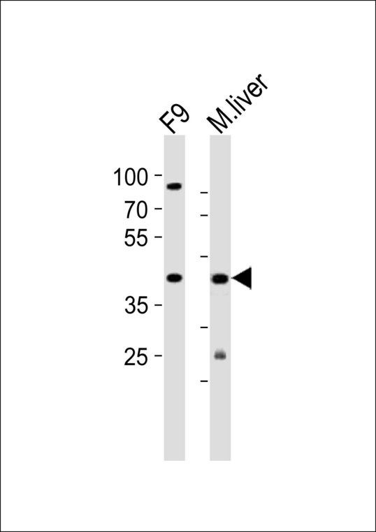Western blot of lysates from mouse F9 cell line and mouse liver tissue (from left to right) with (Mouse) Ubtfl1 Antibody. Antibody was diluted at 1:1000 at each lane. A goat anti-rabbit IgG H&L (HRP) at 1:10000 dilution was used as the secondary antibody. Lysates at 20 ug per lane.