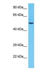 Western blot of UBXN7 Antibody with human PANC1 Whole Cell lysate.