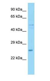 UBXN6 / UBXD1 antibody Western Blot of Mouse Heart.