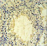 UBXN6 Antibody IHC of formalin-fixed and paraffin-embedded mouse testis tissue followed by peroxidase-conjugated secondary antibody and DAB staining.