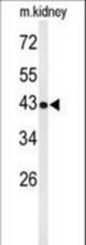 Western blot of UBXN6 Antibody in mouse kidney tissue lysates (35 ug/lane). UBXN6 (arrow) was detected using the purified antibody.