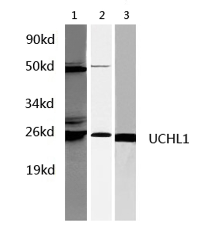 Western blot of UCHL1 pAb in extracts from HepG2, Rat liver and mouse brain tissues.