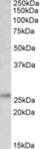UCHL1 antibody (0.3 ug/ml) staining of Rat Brain lysate (35 ug protein/ml in RIPA buffer). Primary incubation was 1 hour. Detected by chemiluminescence.