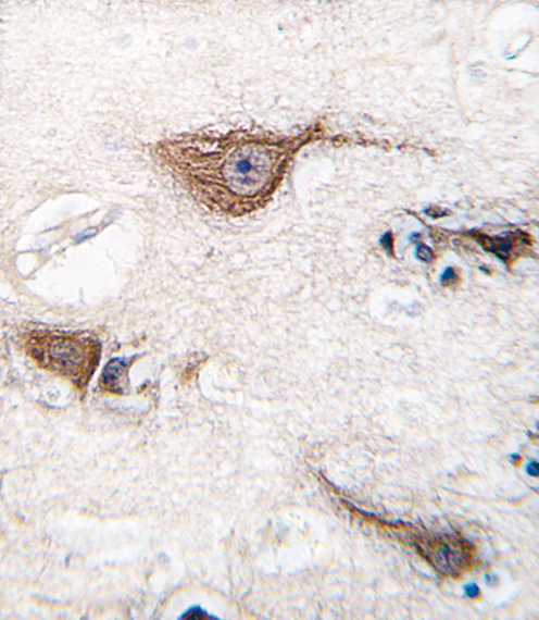 Formalin-fixed and paraffin-embedded human brain tissue reacted with UCHL1 (Park5) antibody , which was peroxidase-conjugated to the secondary antibody, followed by DAB staining. This data demonstrates the use of this antibody for immunohistochemistry; clinical relevance has not been evaluated.