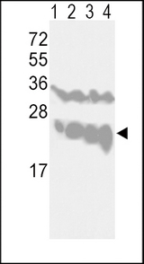 Western blot of UCHL1-V31 in CEM(lane 1), Jurkat(lane 2), Y79(lane 3) cell line and mouse brain tissue(lane 4) lysates (35 ug/lane). UCHL1 (arrow) was detected using the purified antibody.