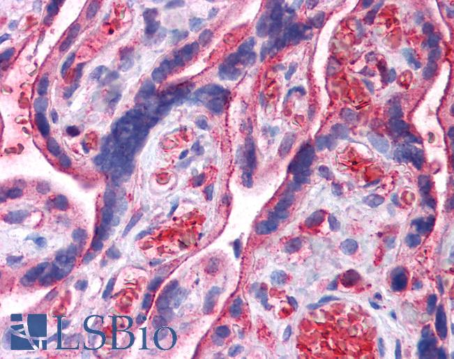 Anti-UCHL3 antibody IHC of human placenta. Immunohistochemistry of formalin-fixed, paraffin-embedded tissue after heat-induced antigen retrieval. Antibody LS-B4688 concentration 5 ug/ml.