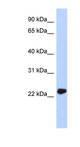 UCHL3 antibody LS-B4688 Western blot of MCF7 cell lysate.
