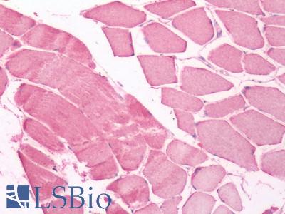 Human Skeletal Muscle: Formalin-Fixed, Paraffin-Embedded (FFPE)