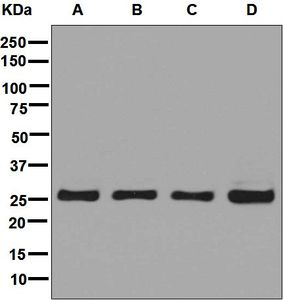 Western blot analysis on (A) K562, (B) 293T, (C) SH-SY5Y, and (D) Jurkat cell lysates using anti-UCHL3 antibody.