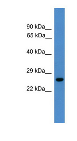 UCHL3 antibody LS-C116945 Western blot of Fetal Liver lysate.