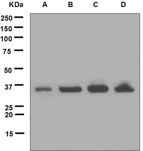 Western blot analysis on (A) fetal kidney, (B) 293T, (C) NCCIT and (D) SH-SY5Y cell lysates using anti-UCHL5/UCH37 antibody.
