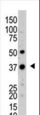 The anti-UCHL5 antibody is used in Western blot to detect UCHL5 in mouse kidney tissue lysate.