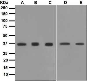 Western blot analysis on (A) 293T, (B) fetal kidney, (C) JAR, (D) SH-SY5Y, and (E) NCCIT lysates using anti-UCHL5 / UCH37 antibody.