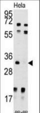Western blot of anti-UCK2 Antibody pre-incubated with and without blocking peptide (BP7192a) in HeLa cell line lysate. UCK2(arrow) was detected using the purified antibody.