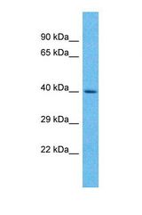 Western blot of Human 721_B. UCKL1 antibody dilution 1.0 ug/ml.