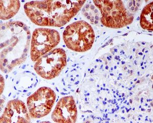 IHC of paraffin-embedded human kidney tissue using anti-UCKL1 antibody.