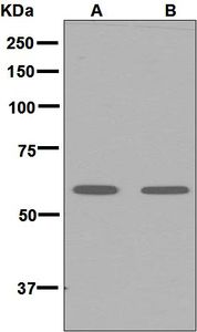 Western blot analysis on (A) 293T and (B) HeLa cell lysates using anti-UCKL1 antibody.